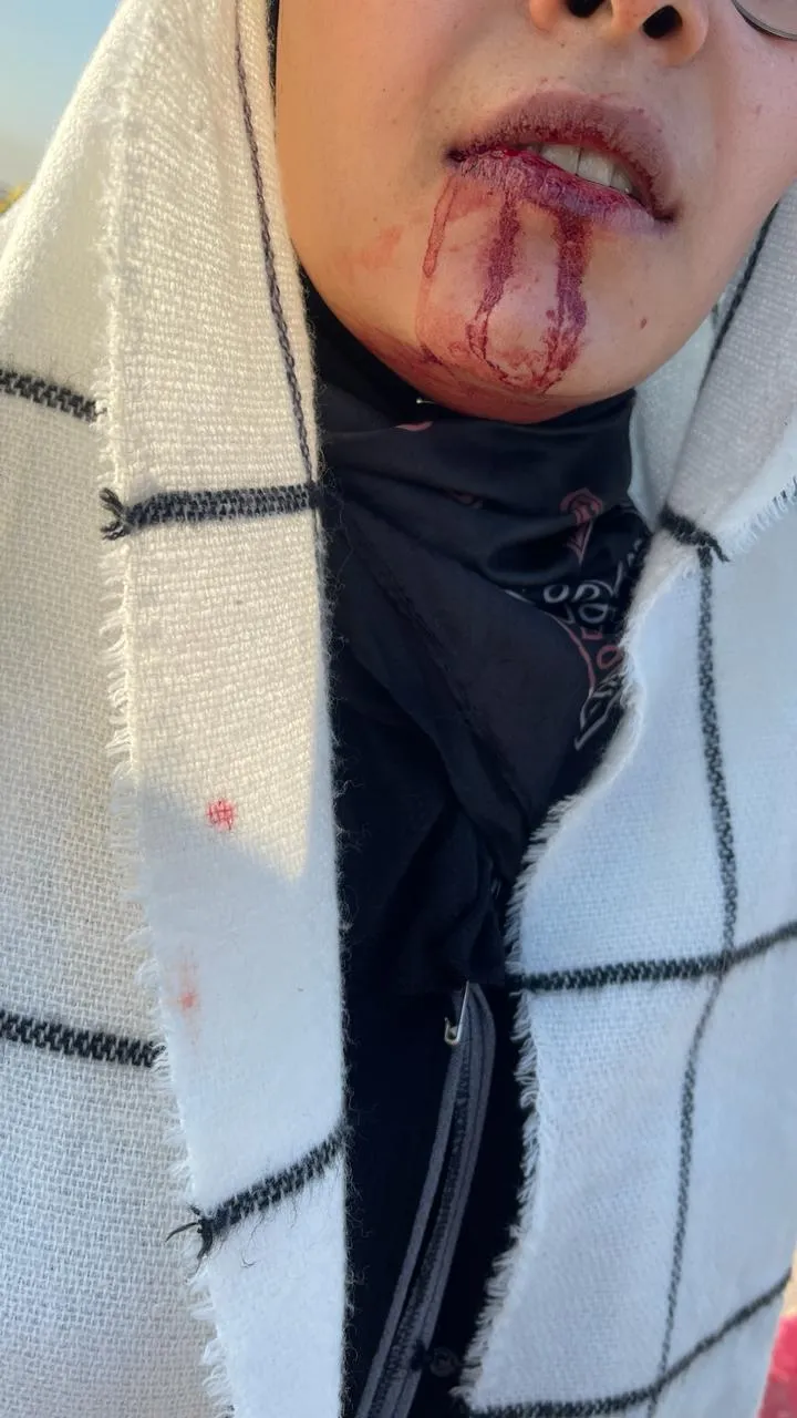 WhatsApp Image 2024 02 20 At 8.39.30 AM